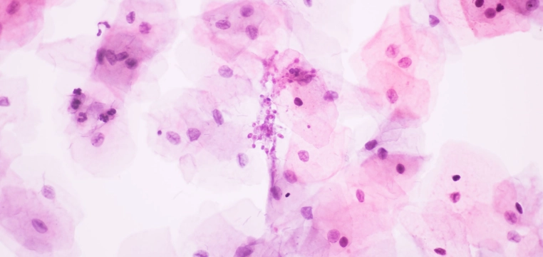 Candida albicans