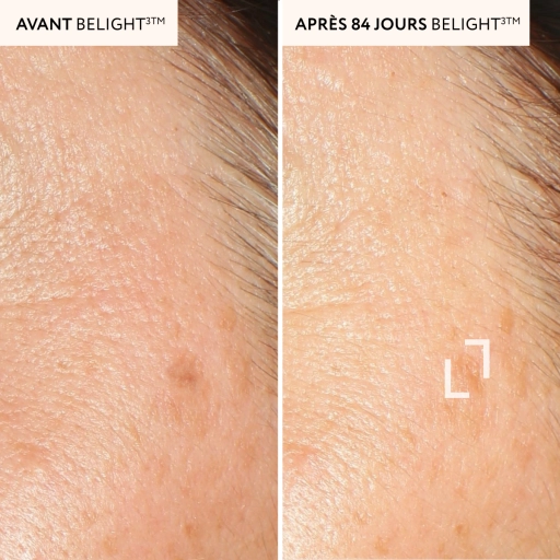 PROTECTODERM ANTI TACHES