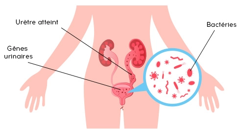 schéma gênes urinaires